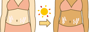 肉割れ日焼け